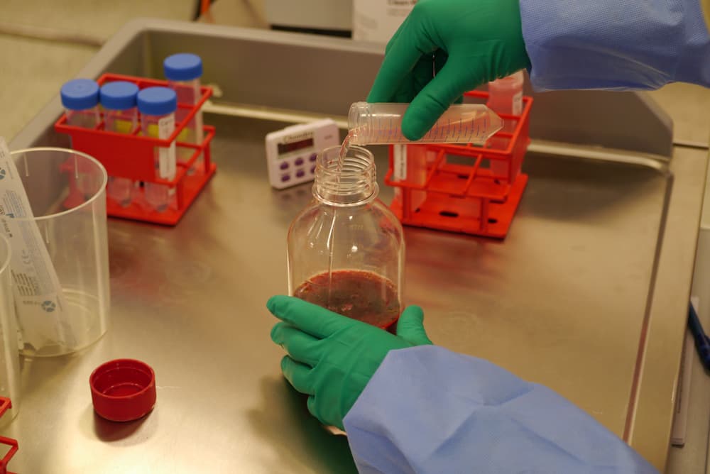 STACi cell processing in theatre at London Cartilage Clinic